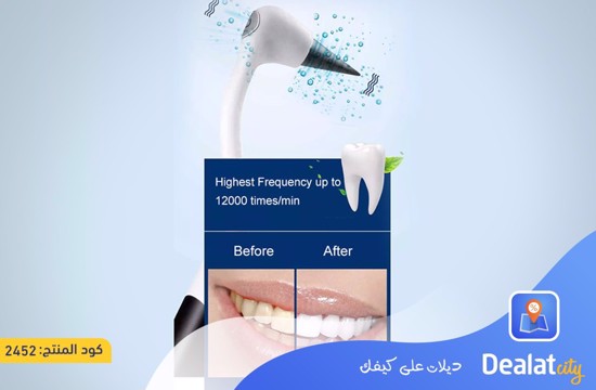 5 in 1 Electric Ultrasonic Oral Irrigator - DealatCity Store